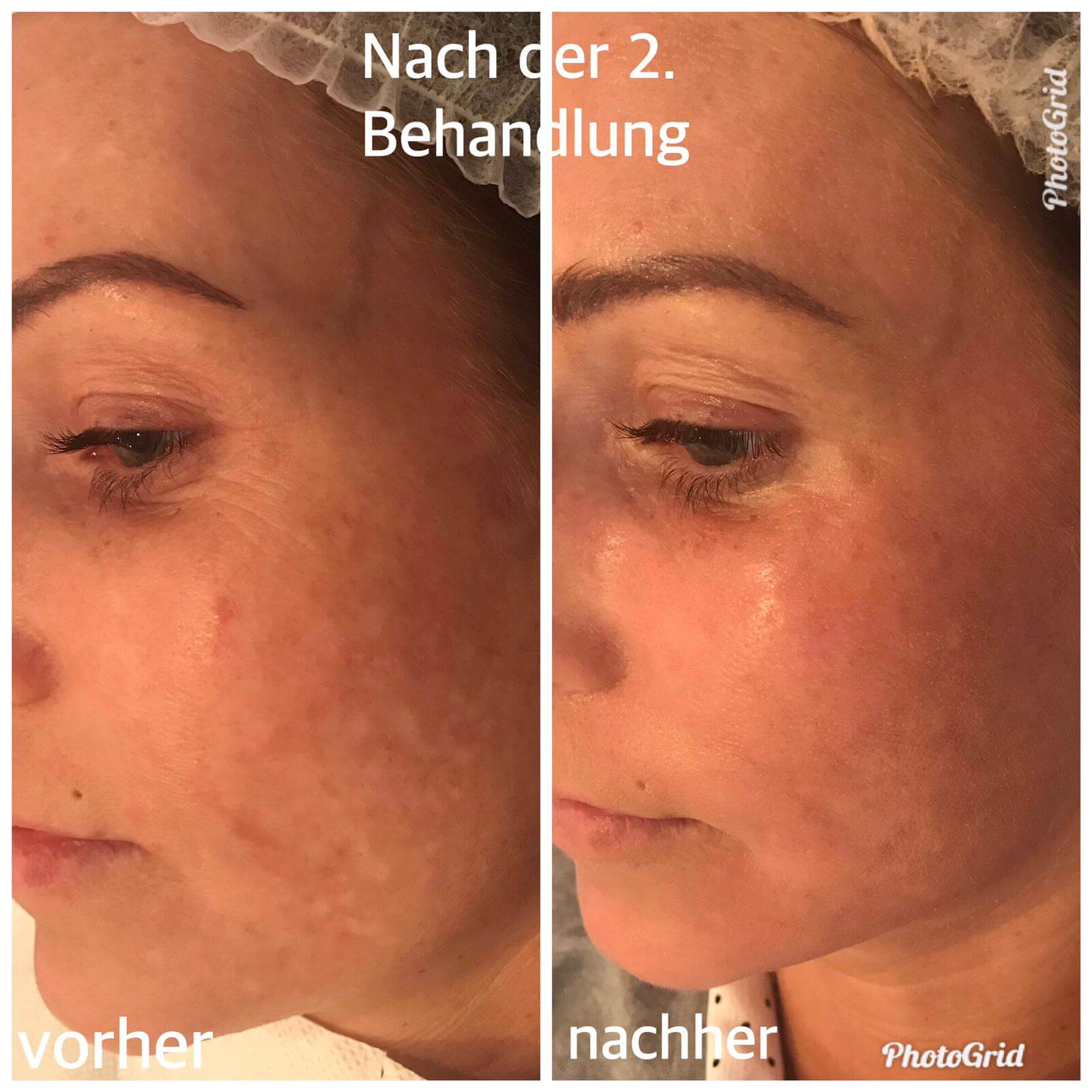 permanent make up lippen wien