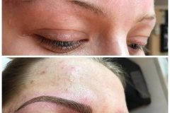 Microblading